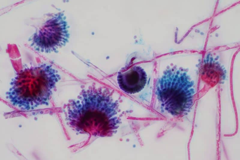 Mold toxicity and CIRS treatment – Dr. Jamie Ahn ND, Norwalk CT