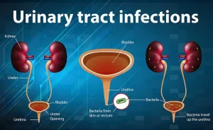 Recurrent UTI naturopathic treatment – Dr. Jamie Ahn ND, Norwalk CT